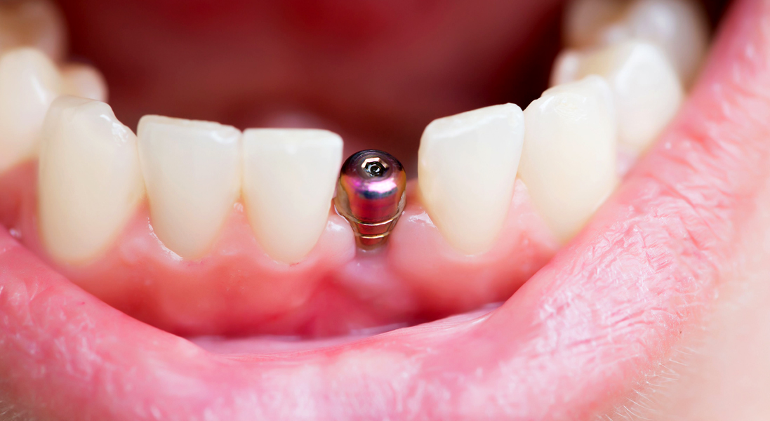 Diş Hekimi Güneş Çankaya Ağız ve Diş Sağlığı Merkezi